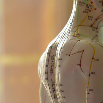 Méthode-d'équilibrage-Acupuncture
